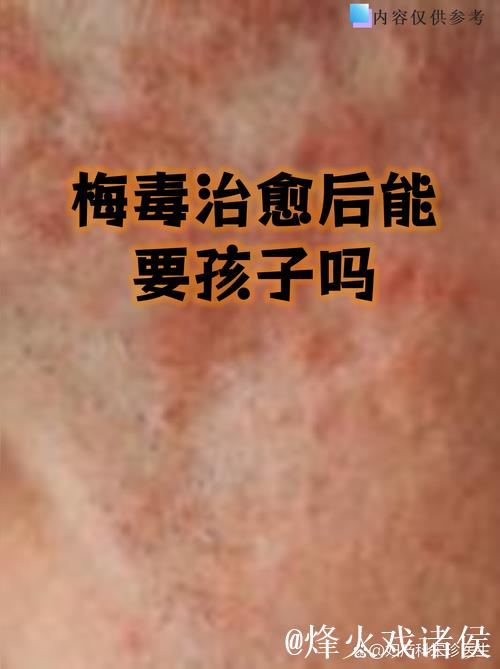 德甲德乙中首位确诊球员康复“解禁” 德甲德乙中首位确诊球员康复“解禁”